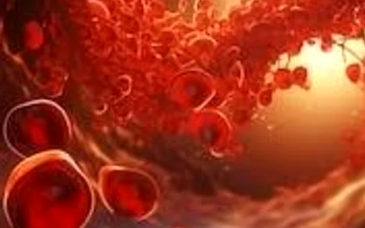 La anemia que no cede puede ser cáncer: el síndrome que afecta la médula ósea