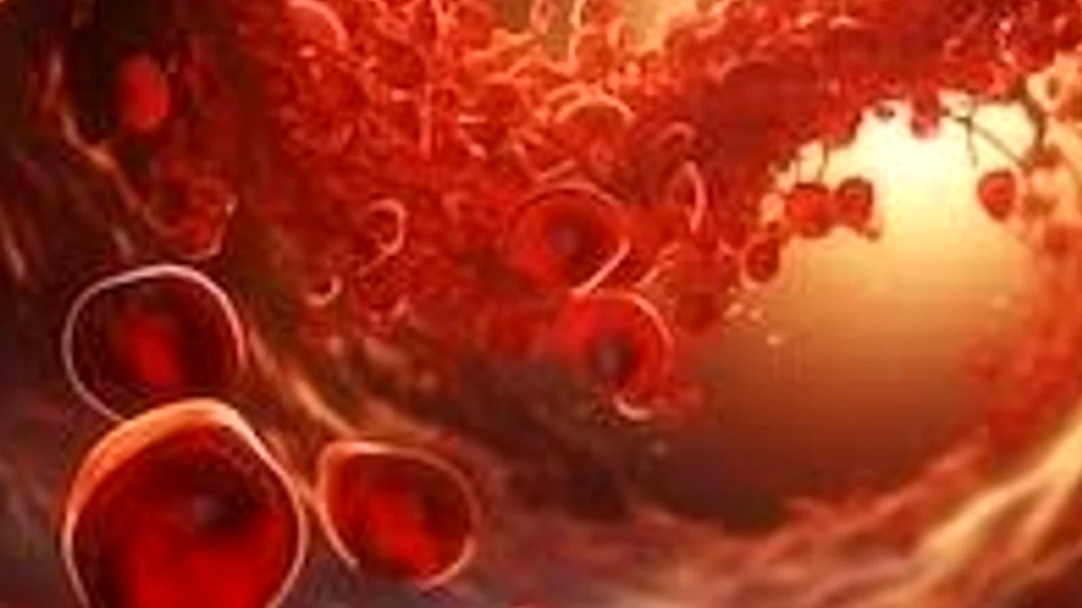 La anemia que no cede puede ser cáncer: el síndrome que afecta la médula ósea